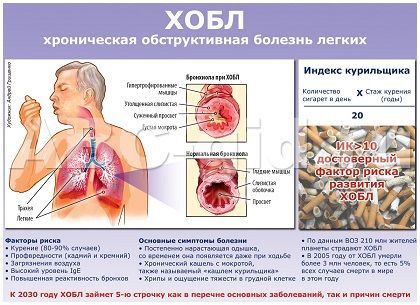 Як лікувати ХОЗЛ у дорослих назавжди: Чи можна вилікувати ХОЗЛ