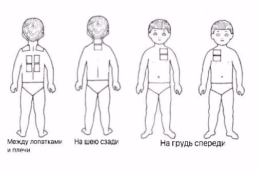 Як лікувати кашель сухою гірчицею