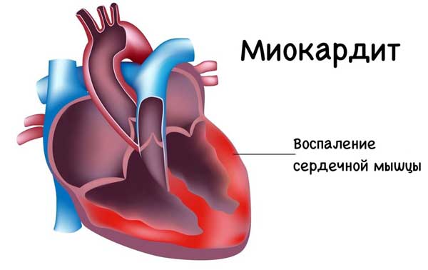 Як лікувати кашель у літніх людей