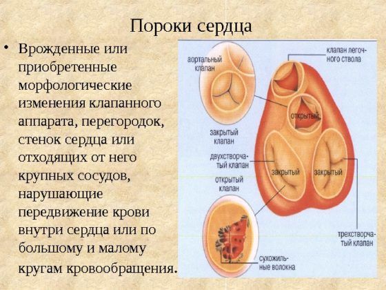Як лікувати кашель у літніх людей