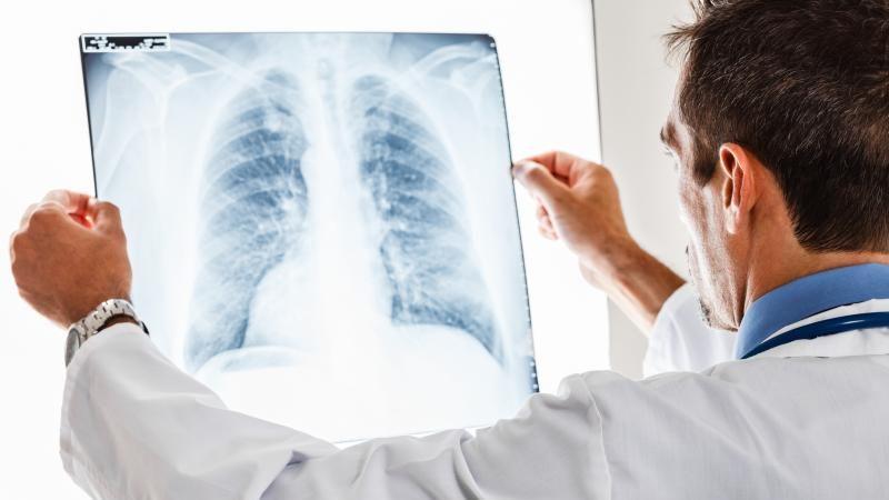 Як лікувати кашель у лежачих хворих