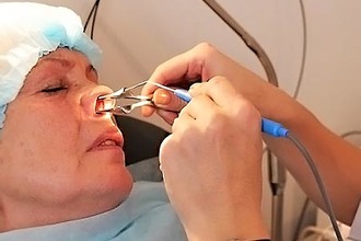 Як лікувати кашель від синуситу