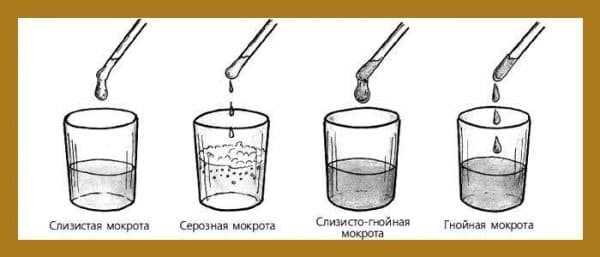 Як лікувати кашель з мокротою у дорослих і дітей