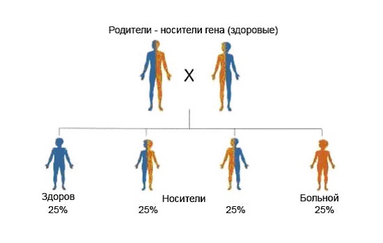 Як лікувати муковісцидоз у дітей