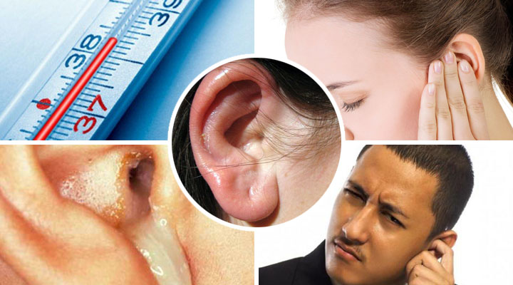 Як лікувати отит середнього вуха у дорослих в домашніх умовах?