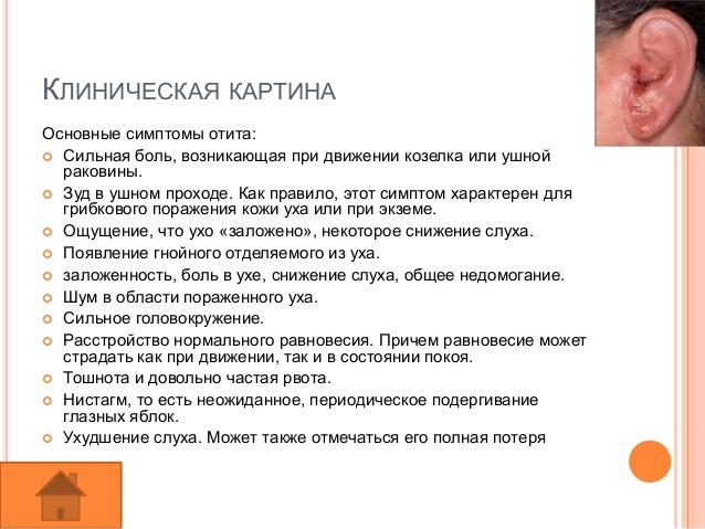Як лікувати отит вуха в домашніх умовах