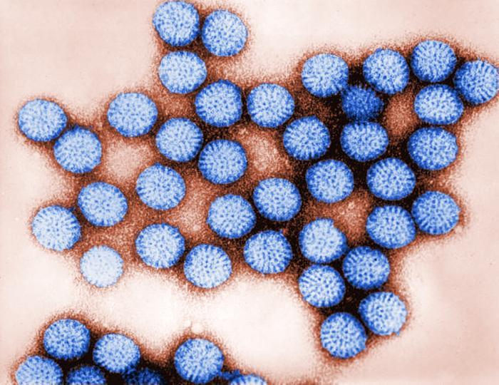 Як лікувати ротавірусну інфекцію