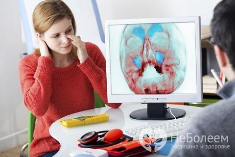 Як лікувати синусит: медикаменти, операції і домашня терапія. Відео — Синусит