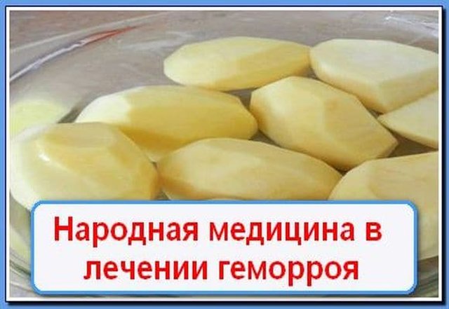 Як можна вилікувати геморой в домашніх умовах