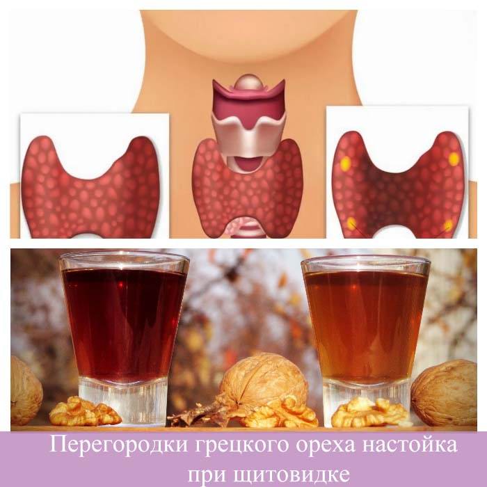 Як наполягати перегородки волоських горіхів від вузлів щитовидної залози