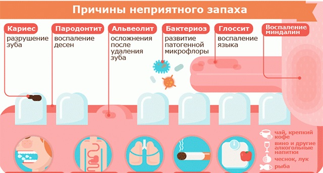 Як перемогти неприємний запах з рота