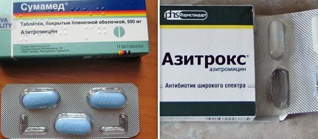 Як приймати Сумамед при гаймориті і синуситі? Сумамед для лікування синуситу Як приймати Сумамед при гаймориті і синуситі? Сумамед для лікування синуситу