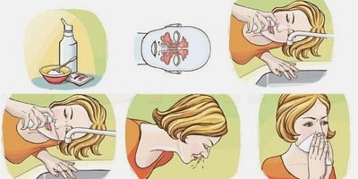 Як промити ніс фізіологічним розчином при нежиті та гаймориті в домашніх умовах