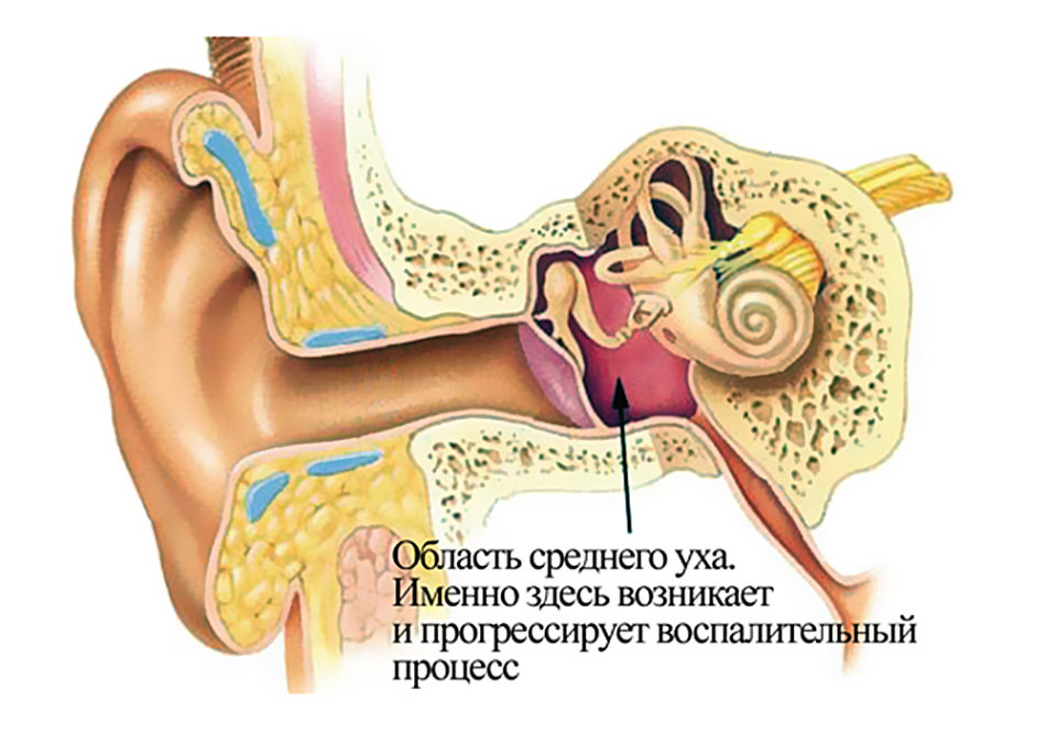 Як проявляється отит у дорослих