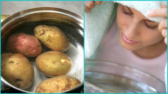Як робити інгаляції над картоплею при нежиті і кашлю