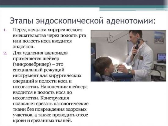 Як роблять ендоскопічне дослідження носа