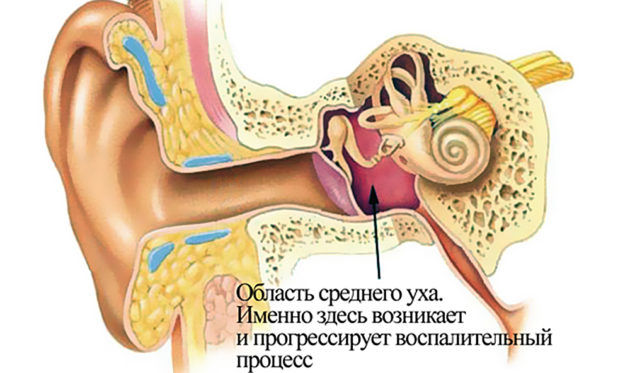 Як розпізнати і вилікувати запалення слухової труби