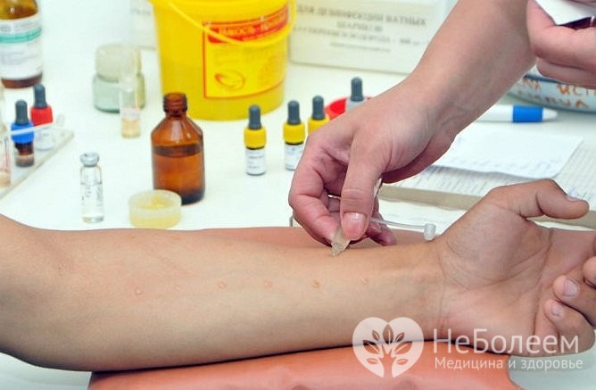 Як відрізнити алергічний бронхіт основні симптоми