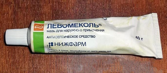 Як виготовити і використовувати турунди в ніс при нежиті та гаймориті? Ватні тампони в ніс при гаймориті