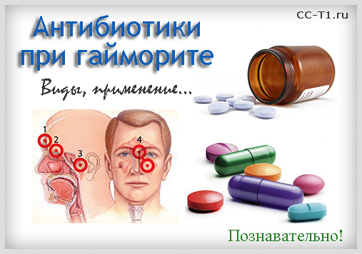Як використовують пеніцилін в лікуванні гаймориту