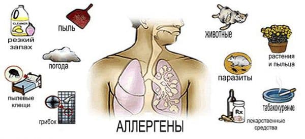 Як вилікувати алергічний риніт при вагітності