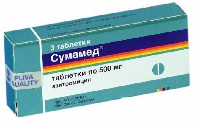 Як вилікувати тонзиліт назавжди: ефективні ліки і рецепти