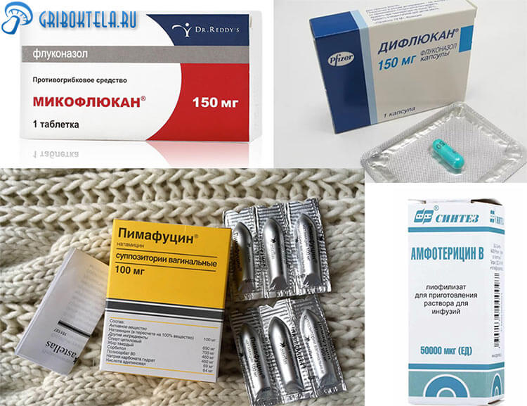 Як виявити ознаки і правильно лікувати фарингомикоз