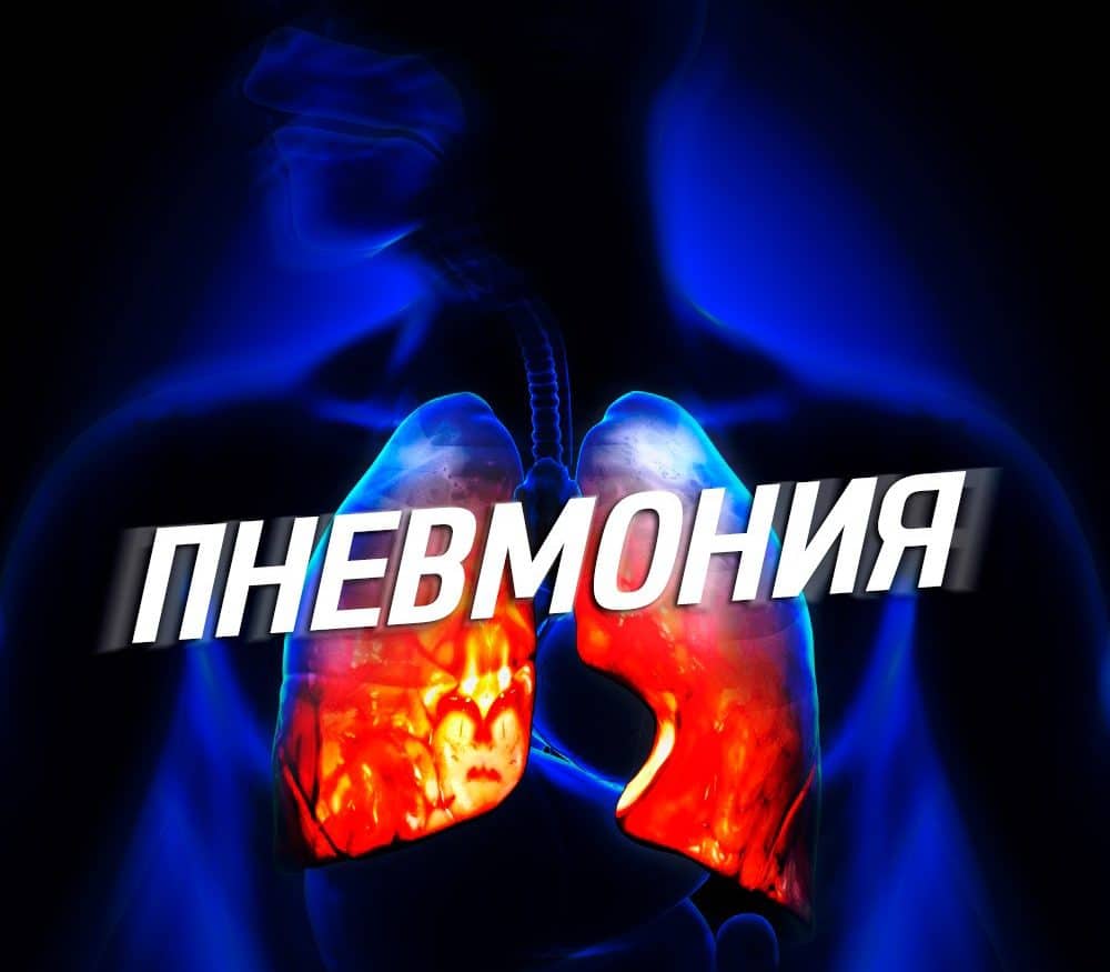 Як визначити пневмонію в домашніх умовах