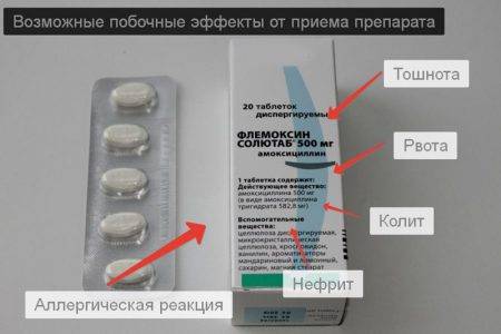 Як застосовувати флемоксин солютаб при отиті