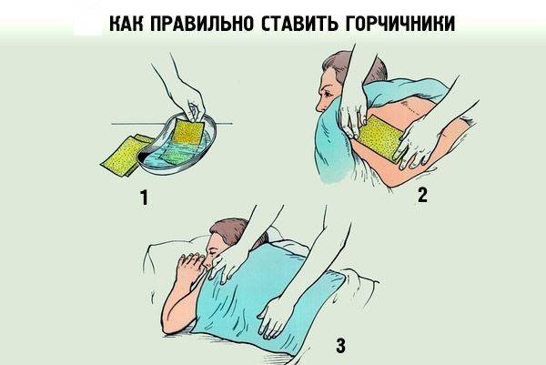 Як застосовувати гірчичники при сухому кашлі