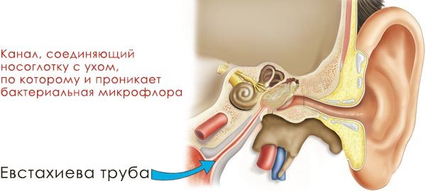 Як зрозуміти що гайморит перейшов у менінгіт