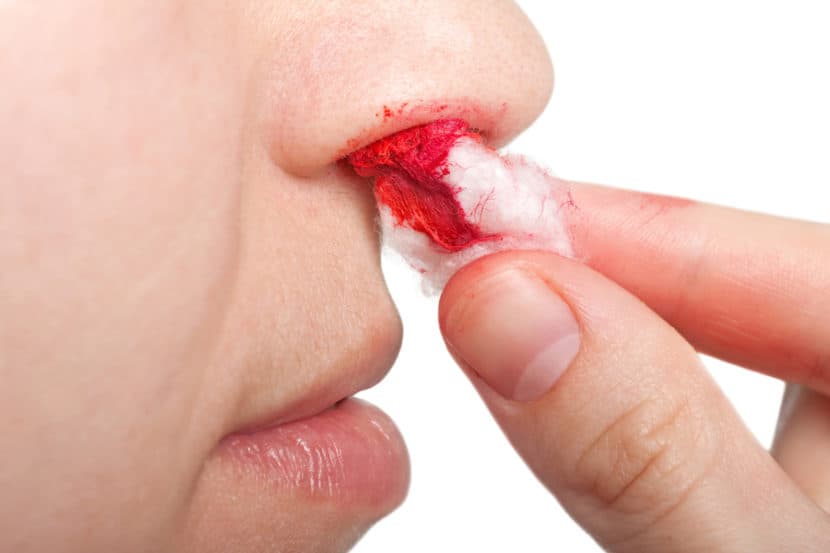 Як зупинити кров з носа
