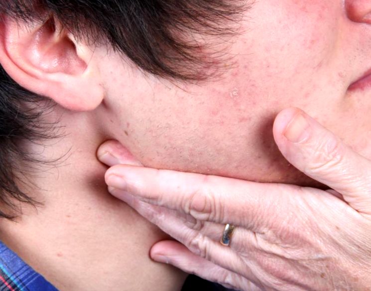 Яка основна причини запалення лімфовузлів на шиї