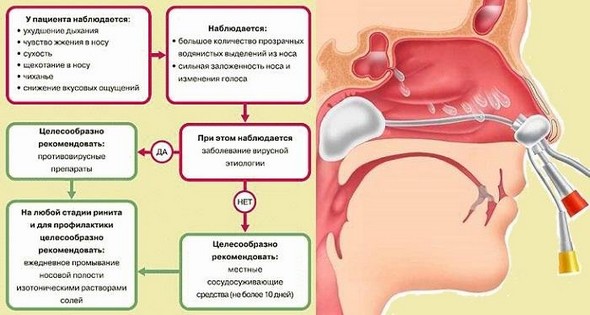 Задній риніт у дорослих: симптоми та види, як і чим лікувати, а також, чим небезпечне захворювання