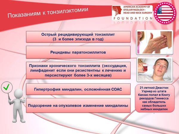 Загострення хронічного тонзиліту симптоми і лікування Загострення хронічного тонзиліту симптоми і лікування