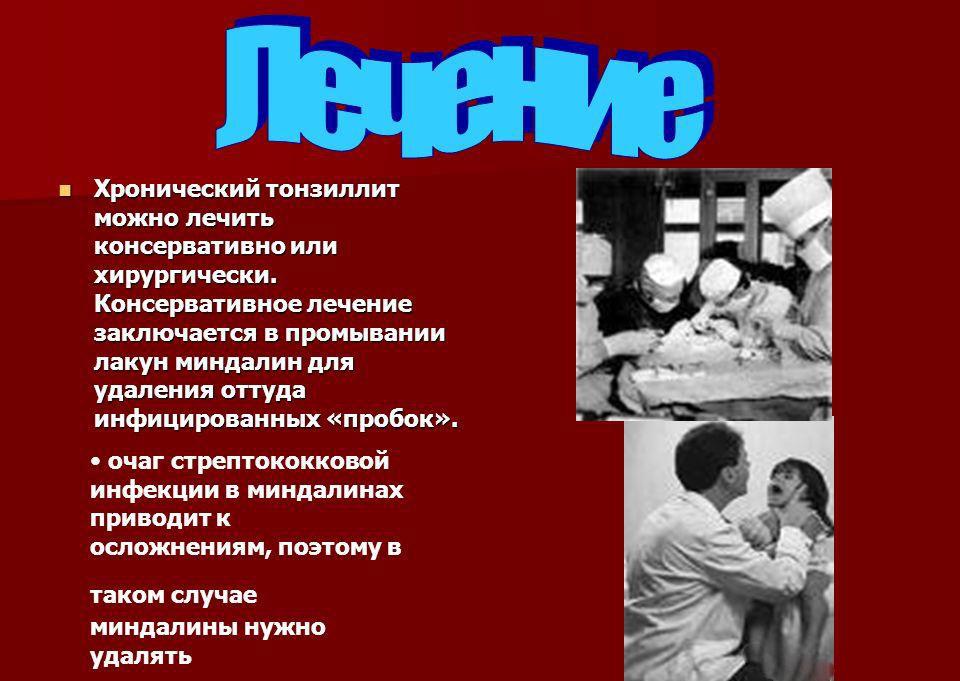 Загострення тонзиліту – як лікувати і що приймати