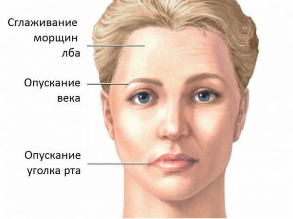 Закладеність вуха після застуди