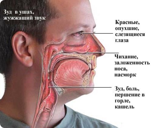 Заклало горло (що робити, які причини викликають). Причини закладеності в горлі і основні підходи до лікування