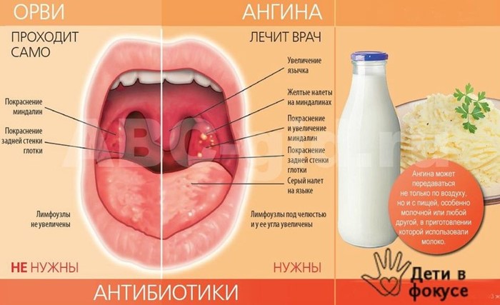 Заклало горло (що робити, які причини викликають). Причини закладеності в горлі і основні підходи до лікування