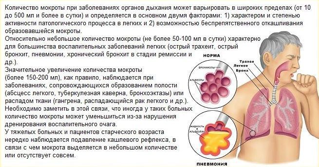Залишковий кашель у дитини після ГРВІ: як швидко вилікувати