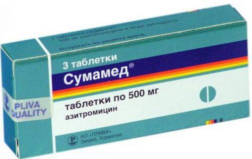 Запалені гланди, що робити