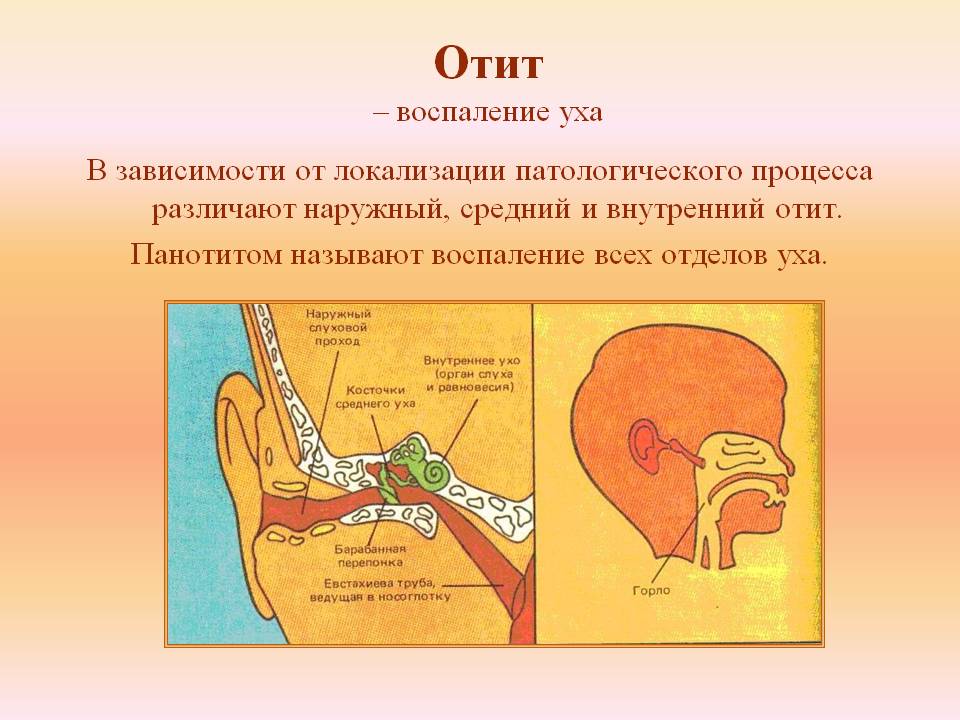 Запалення середнього вуха: симптоми і лікування