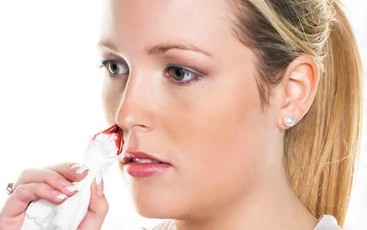Зміцнення судин в носі. Як зміцнити слабкі кровоносні судини в носі